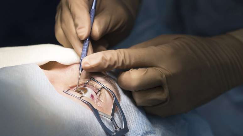 O descobrimento da camada de dua ajuda a tornar as cirurgias oculares mais simples