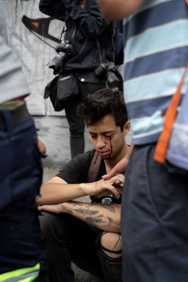 Estudante Gustavo Gatica espera atendimento m&eacute;dico ap&oacute;s ser atingido por bala de borraha durante protesto no Chile
08/11/2019
REUTERS/Osvaldo Pereira