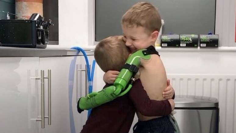 Jacob abraçou o irmão depois que recebeu a prótese