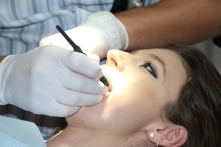 A placa causa a cárie quando os ácidos que ela produz atacam os dentes, o que acontece após as refeições. Sofrendo esses ataques repetidos, o esmalte dos dentes pode se desfazer e abrir caminho para a formação de cárie.