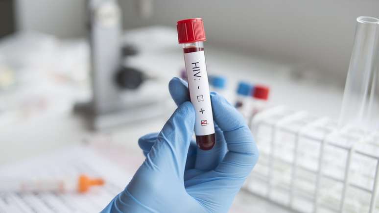 Maior oferta do teste de HIV é um fator que levou ao aumento do número de casos registrados