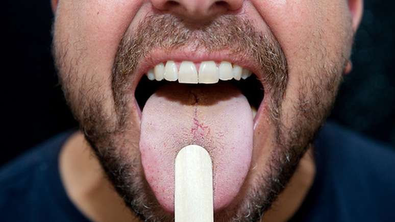 Estudo indica que, além da língua, pacientes que perderam peso também tiveram redução em músculo da mandíbula