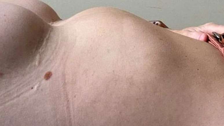 Kerry tamb&eacute;m &eacute; m&atilde;e e faz tratamento com antidepressivos desde o in&iacute;cio do problema