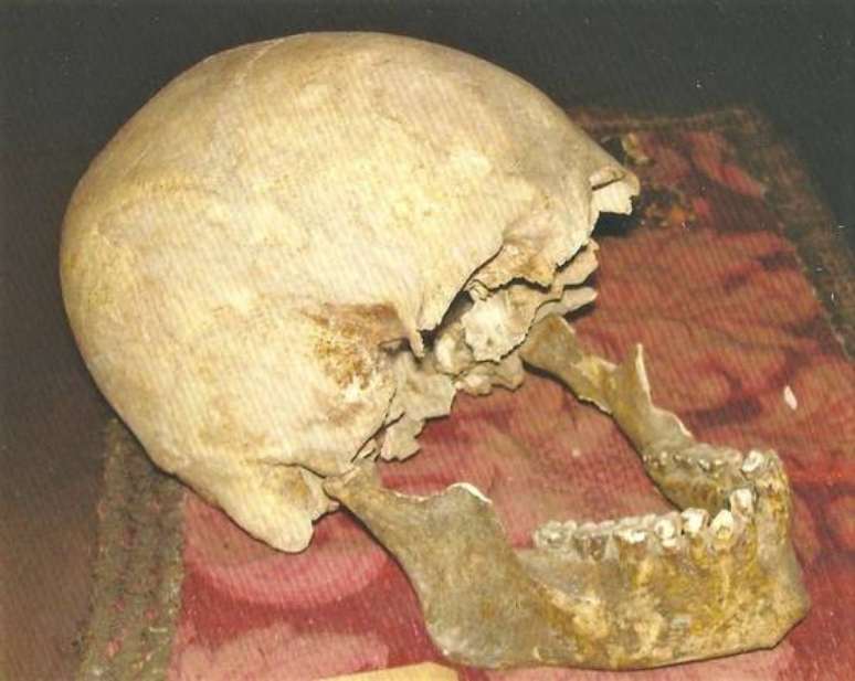 Suposto crânio de Plínio, o Velho