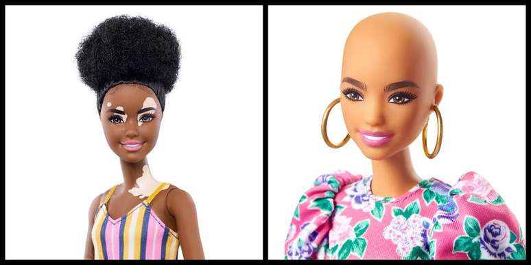 Novas bonecas Barbie tem modelo com vitiligo e sem cabelo.