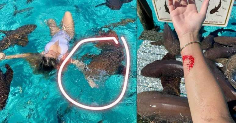 Influenciadora digital Ana Bruna Avila publicou foto do momento em que foi mordida por um tubarão