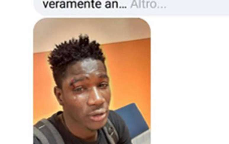 Jovem senegalês é agredido em novo caso de racismo na Itália
