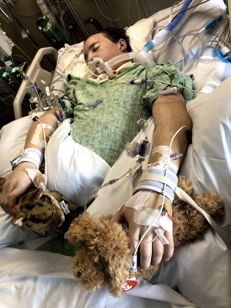 Antes do transplante, Ament foi mantido vivo gra&ccedil;as a uma m&aacute;quina de oxigena&ccedil;&atilde;o por membrana extracorp&oacute;rea, que atua como cora&ccedil;&atilde;o e pulm&otilde;es artificiais, oxigenando e circulando o sangue