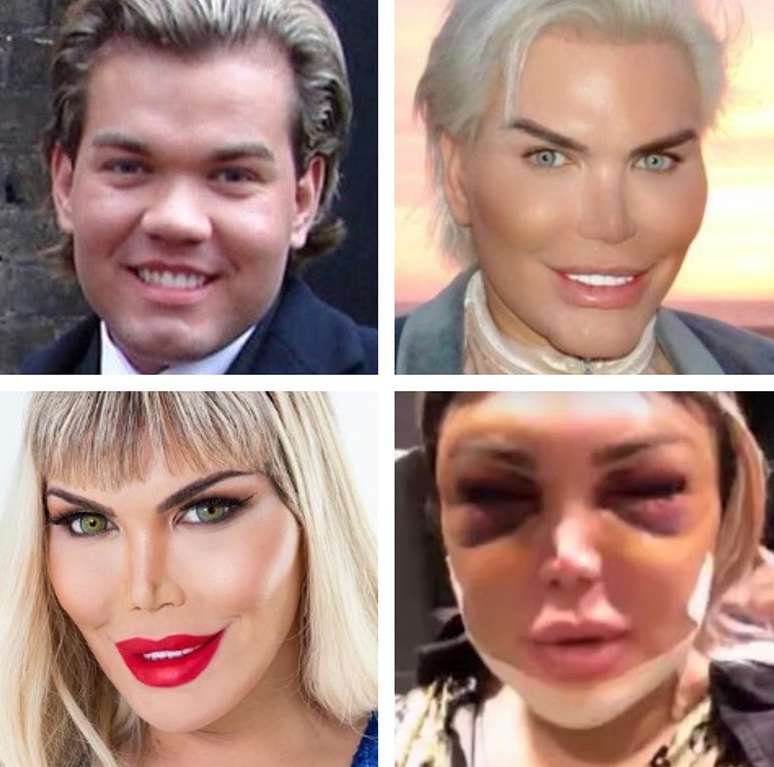 Rodrigo Alves, o Ken humano, assume transexualidade: 'queria ser a