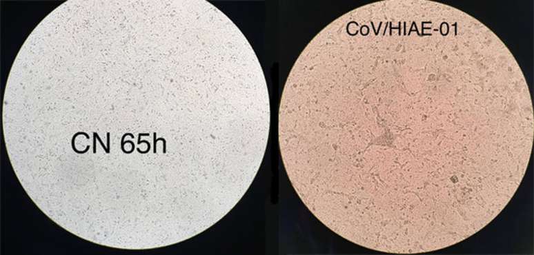 À esquerda, célula humana não infectada; à direita, coronavírus multiplicando-se em célula cultivada em laboratório