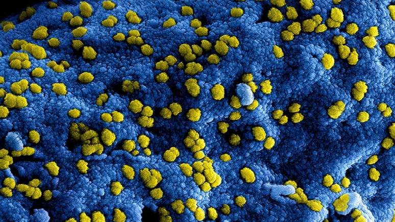 Para se replicar, coronavírus precisa 'sequestrar' célula