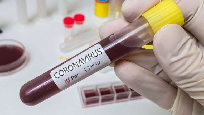 Kits permitirão que o resultado dos testes de coronavírus fique pronto em 15 minutos