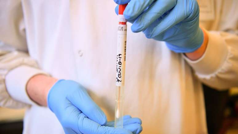 Pacientes com covid-19 t&ecirc;m apresentado diferentes sintomas, entre eles diarr&eacute;ia, dor de cabe&ccedil;a e at&eacute; perda de olfato e paladar