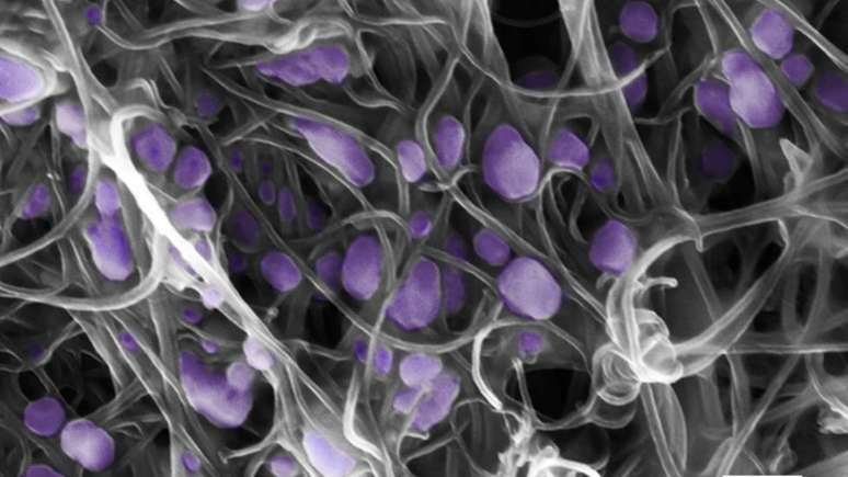 Terrones e sua equipe trabalham com vírus como o H5N2, captado nesta imagem com nanotubos
