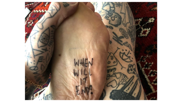 'Quando vai acabar', tatuou Chris na sola do seu pé