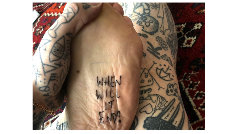 'Quando vai acabar', tatuou Chris na sola do seu p&eacute;