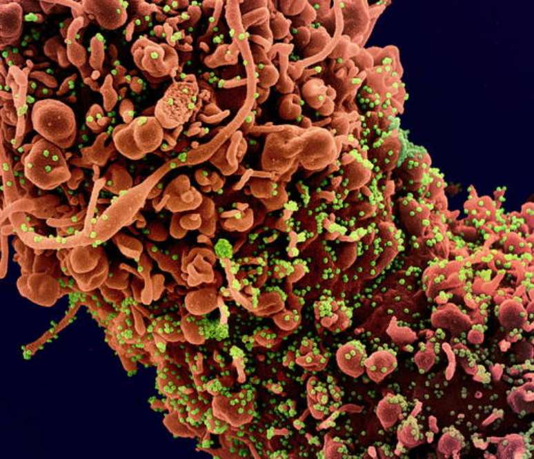 Ilustração do Instituto Nacional de Alergias e Doenças Infecciosas dos EUA mostra ataque do novo coronavírus a células humanas