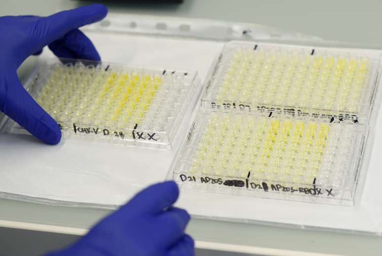 Amostras de exames para coronavírus em laboratório em Berna, na Suíça
22/04/2020 REUTERS/Arnd Wiegmann