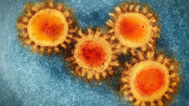 Imagem colorida de microscopia eletr&ocirc;nica do coronav&iacute;rus, que se caracteriza por levar a uma coincid&ecirc;ncia de picos da carga viral e sintomas