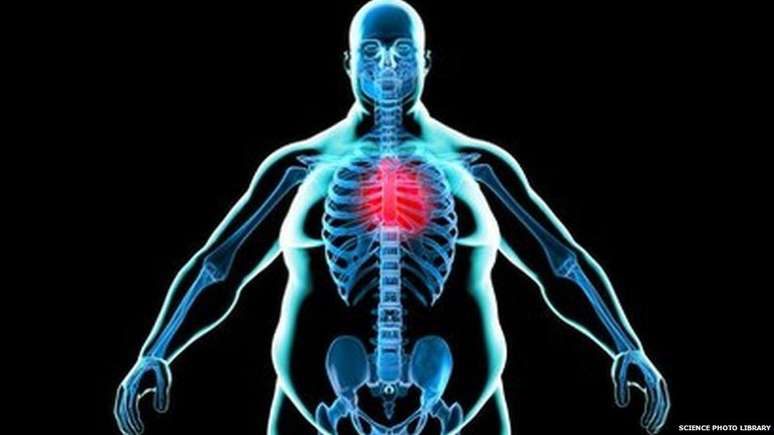 Excesso de peso pode contribuir para apneia