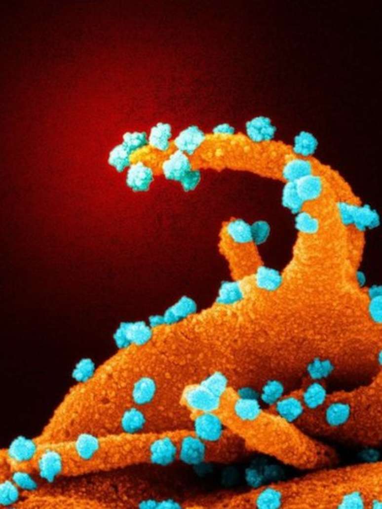 Os filopódios não são comuns, mas já foram observados em infecções por outros vírus, como o de Marburg