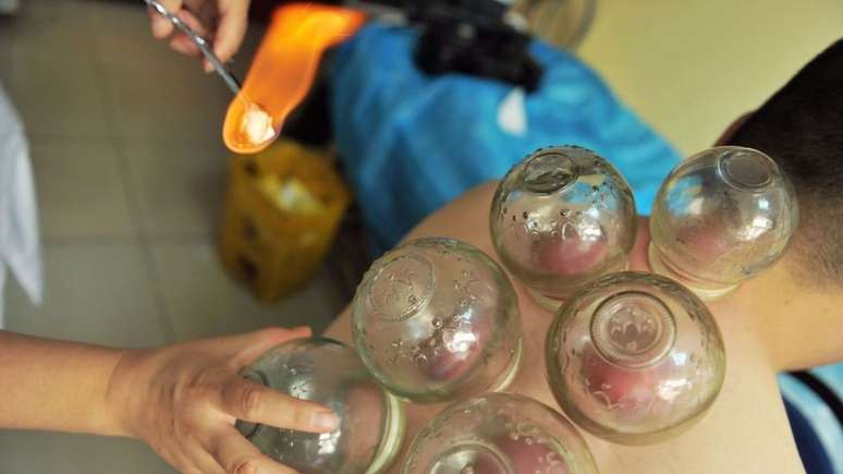 A medicina tradicional chinesa abrange uma ampla gama de tratamentos, desde fitoterapia at&eacute; acupuntura