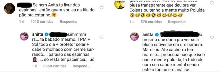 A cantora Anitta respondeu a comentários sobre sua aparência no Instagram