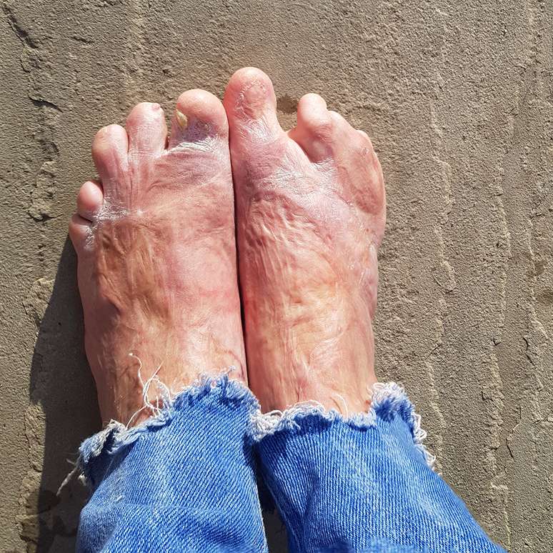 Os p&eacute;s de Laura