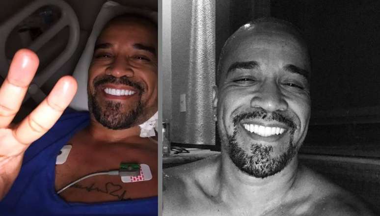 O cantor Fernando Pires está internado depois de sofrer um acidente doméstico