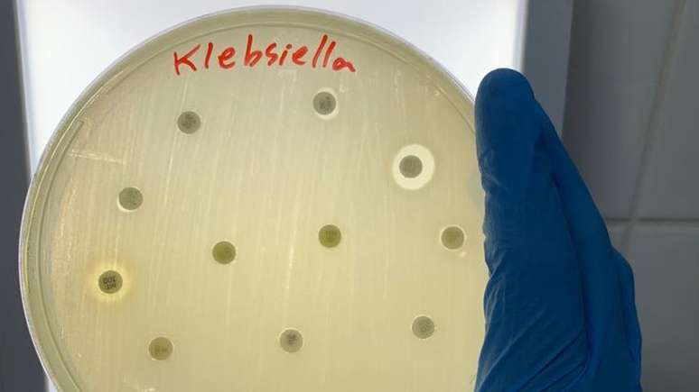 Klebsiella pneumoniae faz parte de categoria 'crítica' das bactérias contra as quais o desenvolvimento de novos remédios é mais urgente, segundo lista da OMS