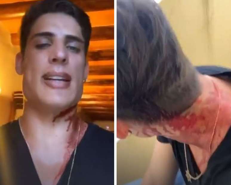 Tiago Ramos apareceu cheio de sangue em vídeos no Instagram