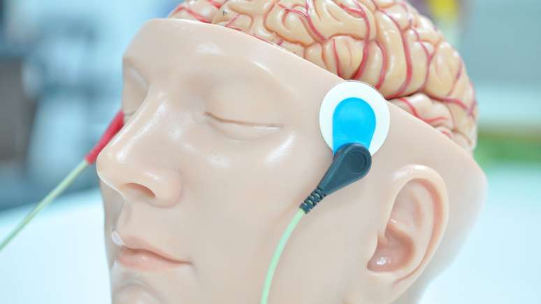 Maquete de um c&eacute;rebro com eletrodos