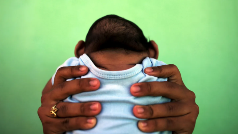 Bebê nascido com microcefalia por conta de síndrome congênita do vírus zika, no Brasil, em 2016; especialistas temem que epidemias do tipo se tornem mais frequentes