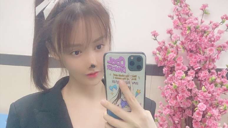 Gao Liu pode ter que esperar anos antes de se submeter a uma cirurgia reconstrutiva