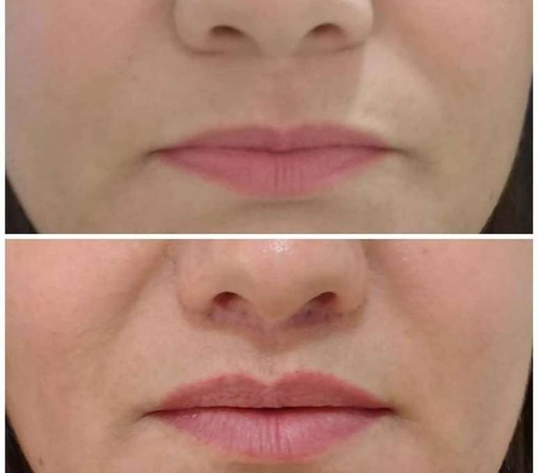 Reprodu&ccedil;&atilde;o / Instagram @instituto.corpory