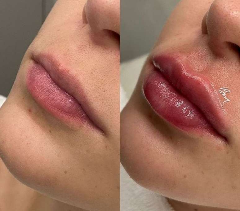 Reprodução / Instagram @dra.brunamuryelle