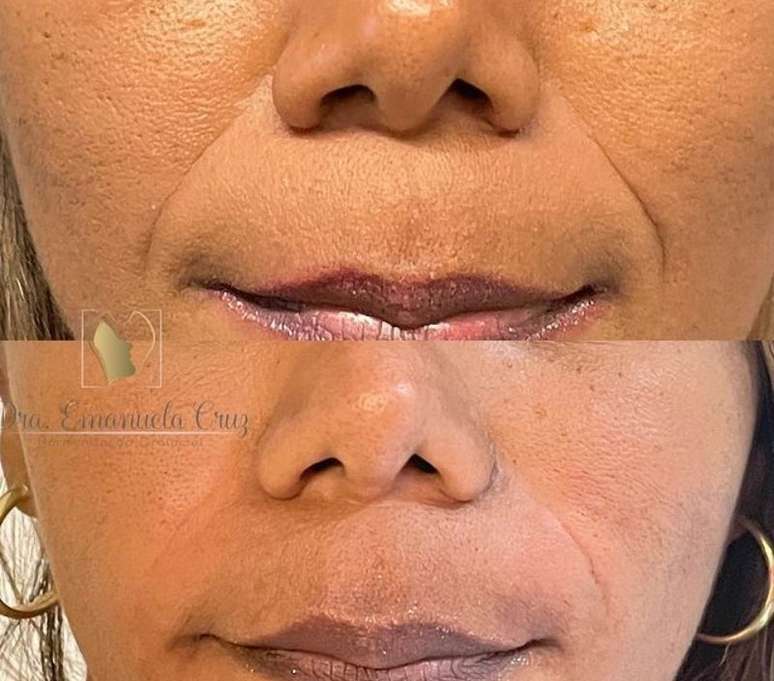 Reprodu&ccedil;&atilde;o / Instagram @draemanuelacruz