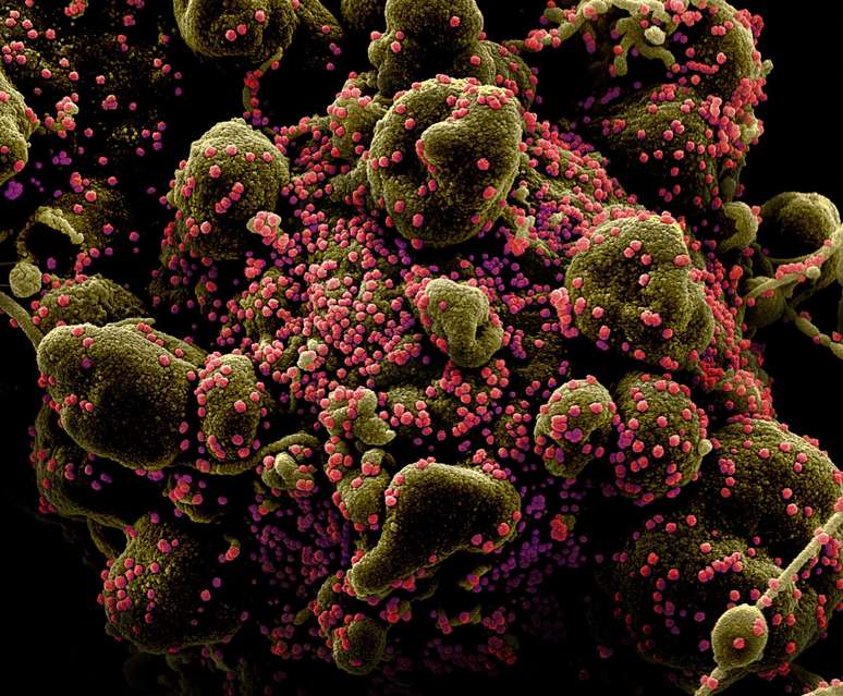 Imagem de célula infectada com coronavírus 
Instituto Nacional de Alergias e Doenças Infecciosas dos EUA/Divulgação via REUTERS