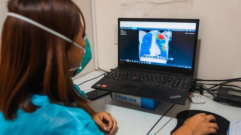 Um software de leitura automatizada baseado em intelig&ecirc;ncia artificial ajuda os m&eacute;dicos a ler radiografias