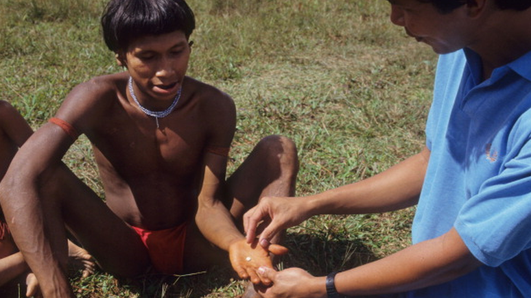 Indígena recebe comprimido de ivermectina no maior programa de doação de medicamentos do mundo. A oncocercose já foi eliminada de quatro países latino-americanos e só é encontrada atualmente na divisa entre Brasil e Venezuela