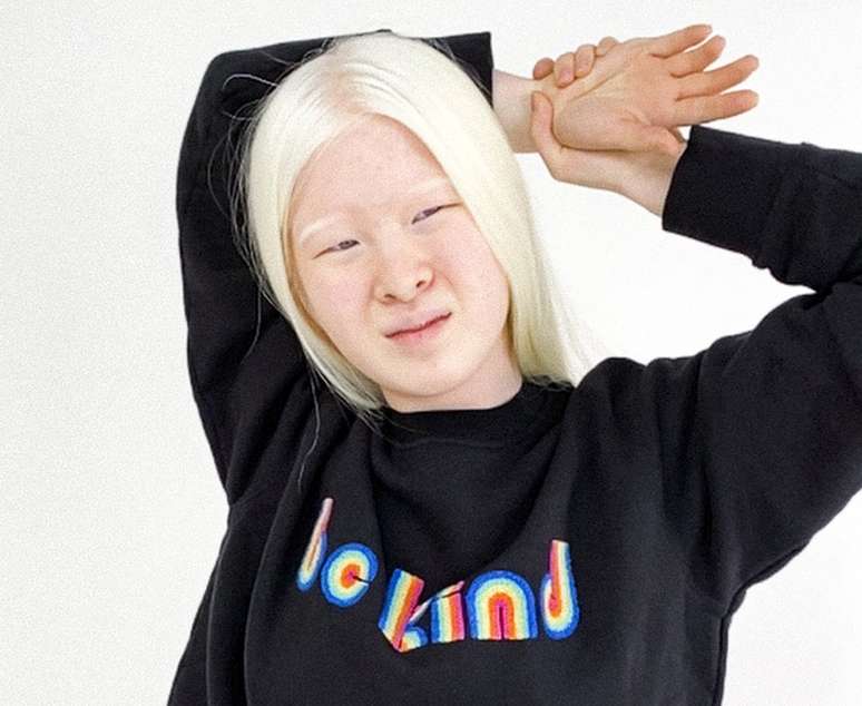 'Na moda, parecer diferente é uma bênção, não uma maldição, e isso me dá uma plataforma para aumentar a conscientização sobre o albinismo'