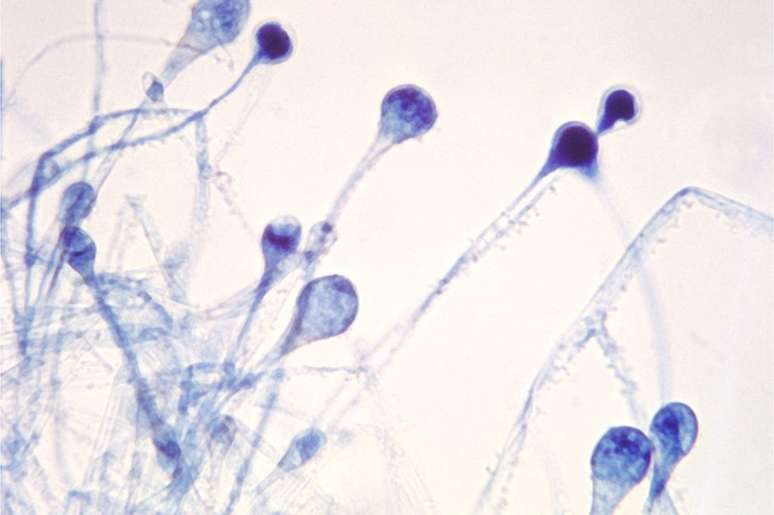 Mucormicose afeta com mais frequência imunodeprimidos