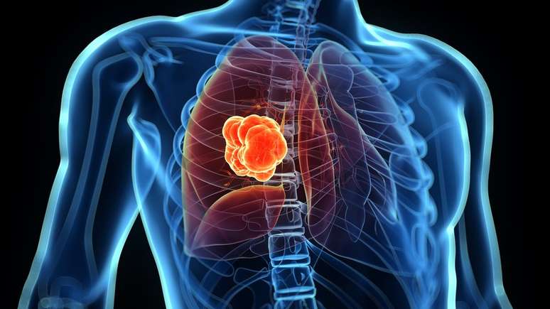 A efic&aacute;cia das defesas contra o c&acirc;ncer diminui com a idade