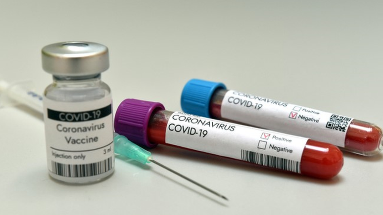 Testes sorológicos feitos em laboratórios são mais sensíveis que os de farmácia, mas também não servem para 'checar' vacina