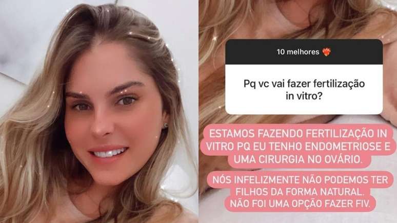 No Instagram, a modelo disse que não foi uma opção a fiv.