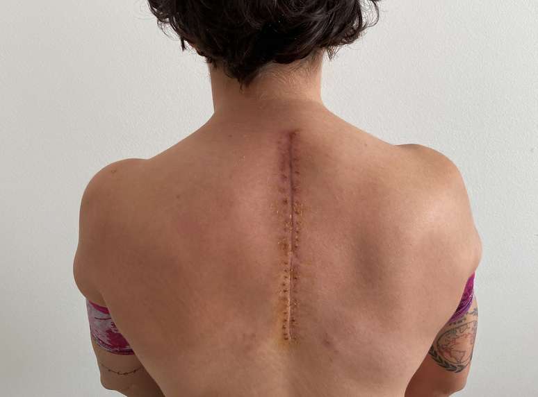 Ana Carrasco precisou de uma cirurgia na coluna após uma forte queda no Estoril 