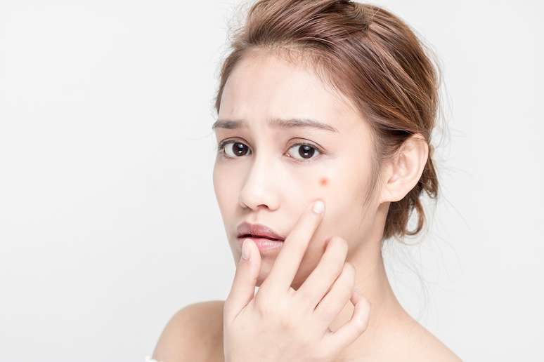 Acne: saiba como as espinhas aparecem e como tratar