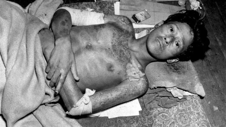 Os efeitos da radia&ccedil;&atilde;o podem ser letais para os humanos