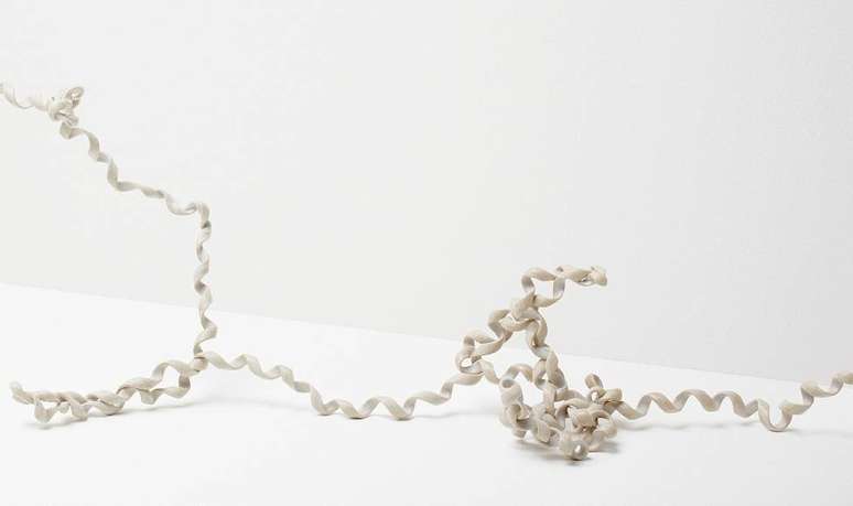 Fios de telefone usados antigamente ficavam torcidos com frequ&ecirc;ncia