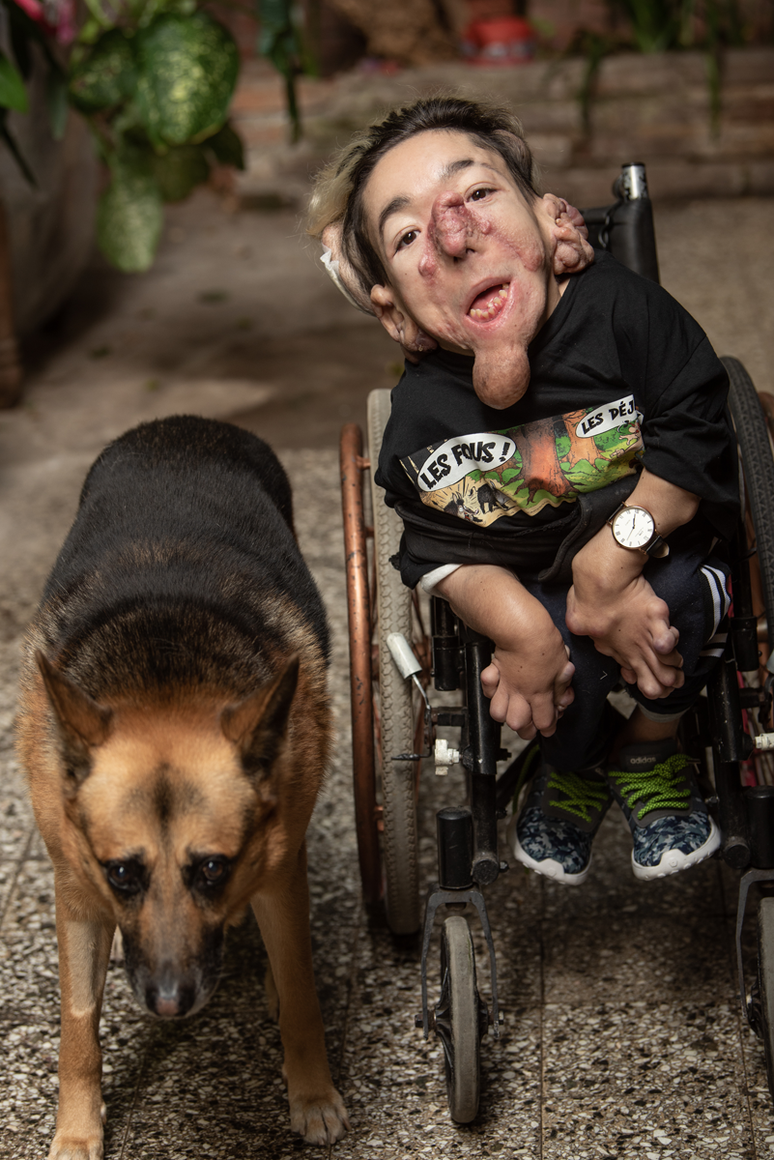 Mat&iacute;as Fern&aacute;ndez Burzaco e Lobito